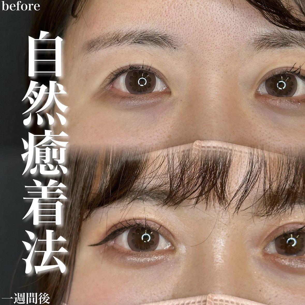 二重埋没
