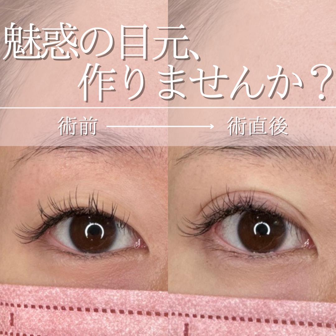 二重埋没