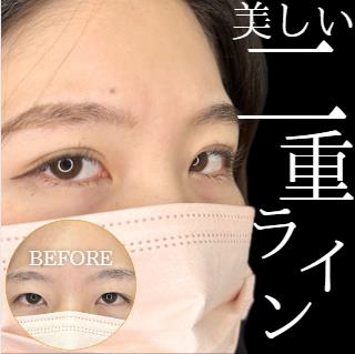 二重埋没
