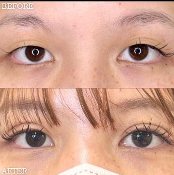 二重埋没