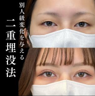 二重埋没