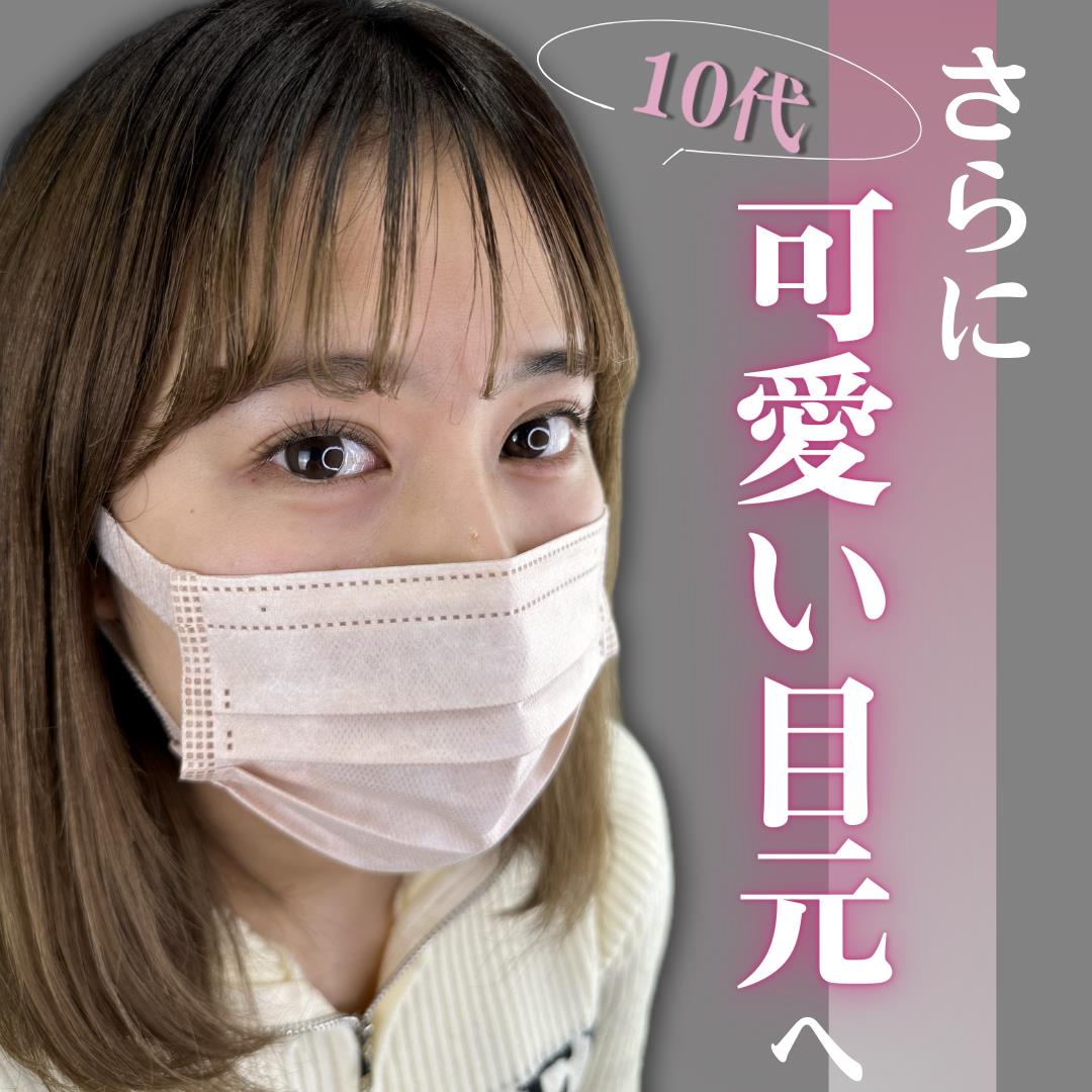 涙袋ヒアルロン酸の症例写真
