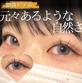 涙袋ヒアルロン酸の症例写真