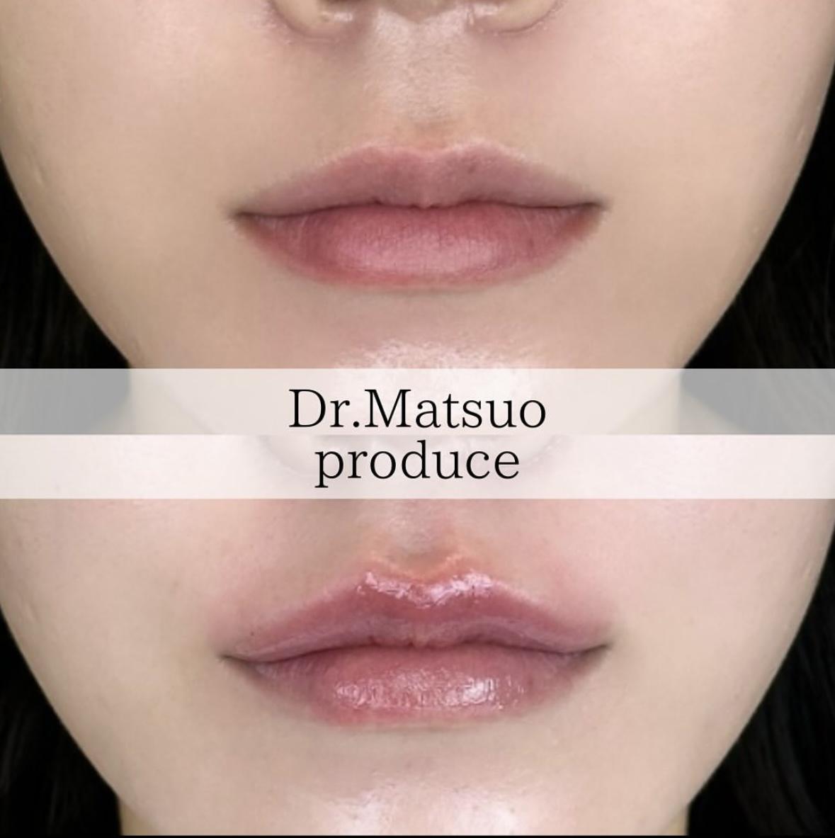 Cカールリップの症例写真