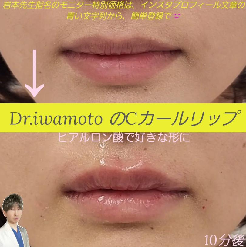 Cカールリップの症例写真