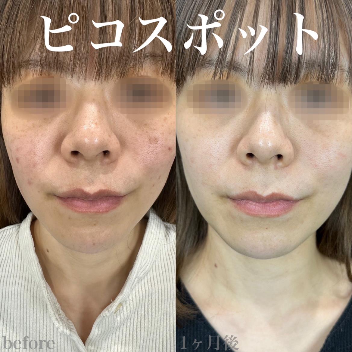 美容皮膚科症例写真