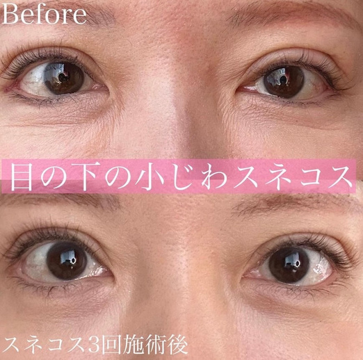 美容皮膚科症例写真