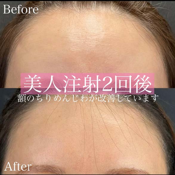 美容皮膚科症例写真