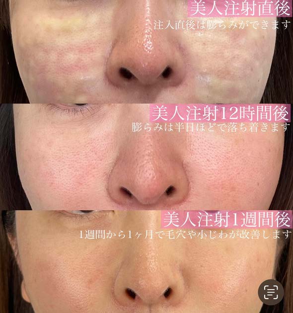 美容皮膚科症例写真