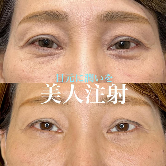 美容皮膚科症例写真