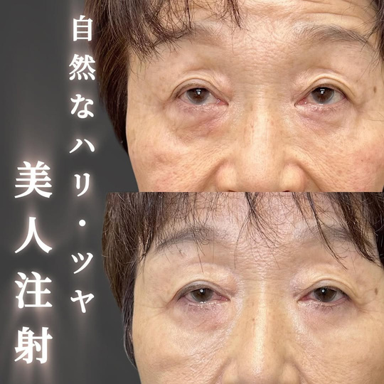美容皮膚科症例写真