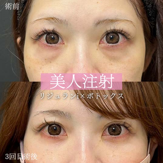 美容皮膚科症例写真