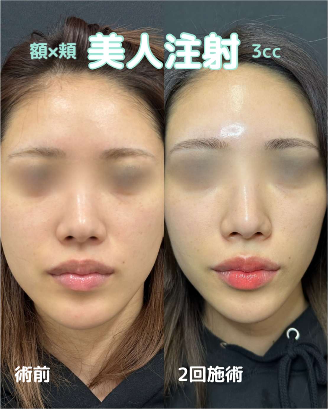 美容皮膚科症例写真