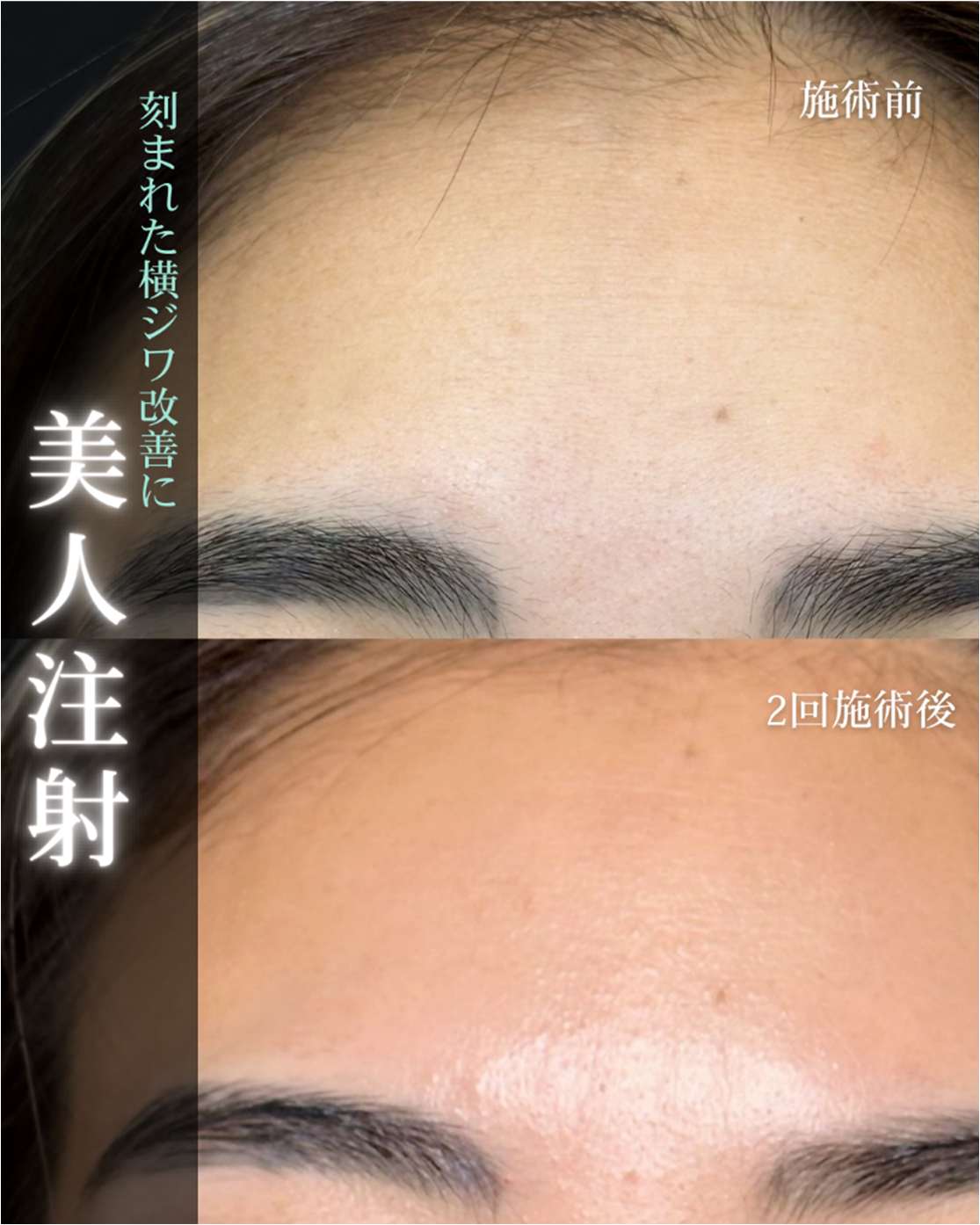 美容皮膚科症例写真