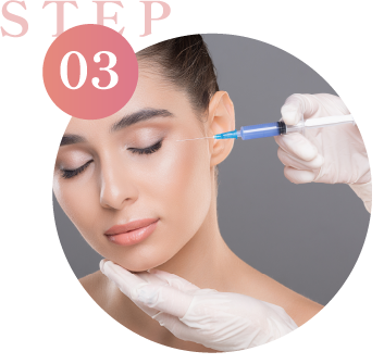 STEP03
