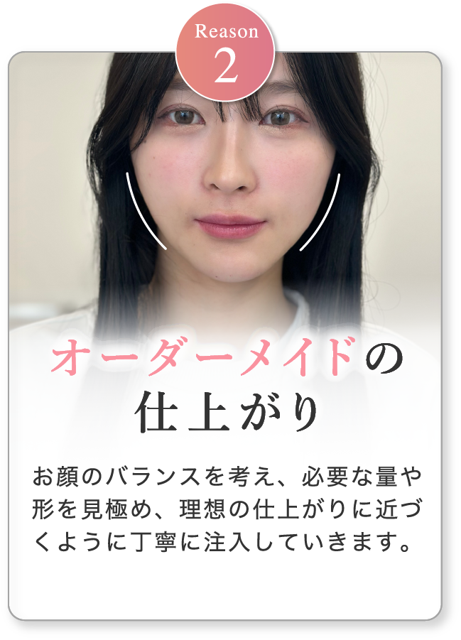 オーダーメイドの仕上がり お顔のバランスを考え、必要な量や形を見極め、理想の仕上がりに近づくように丁寧に注入していきます。