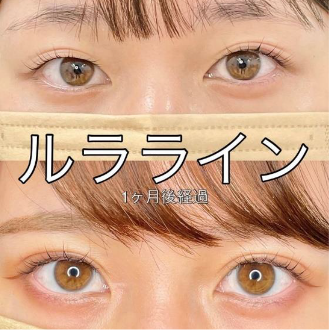 二重症例一覧