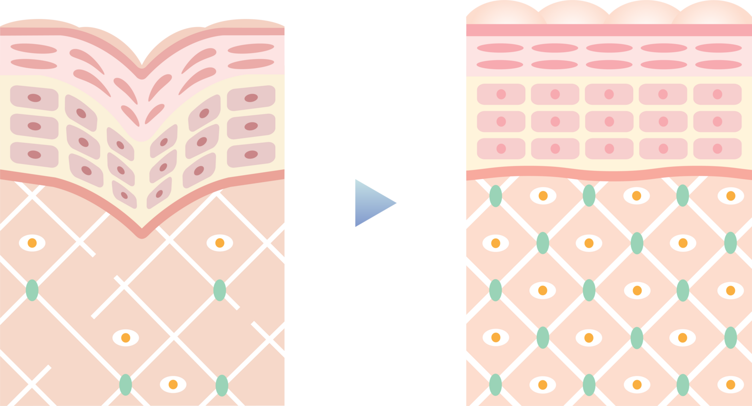 肌の根本部分から若返り