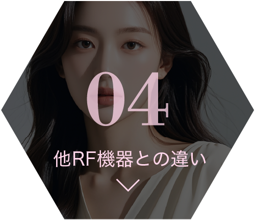 04 他RF機器との違い