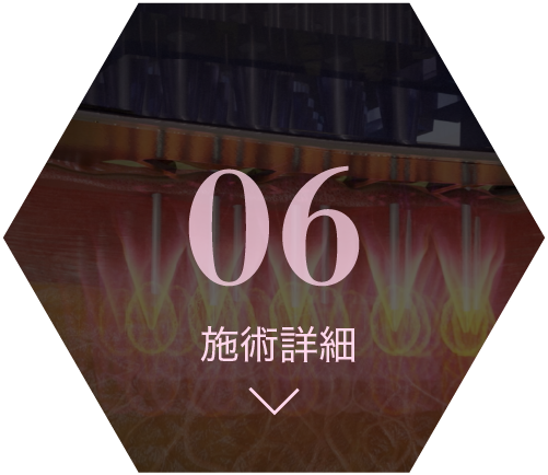 06 施術詳細