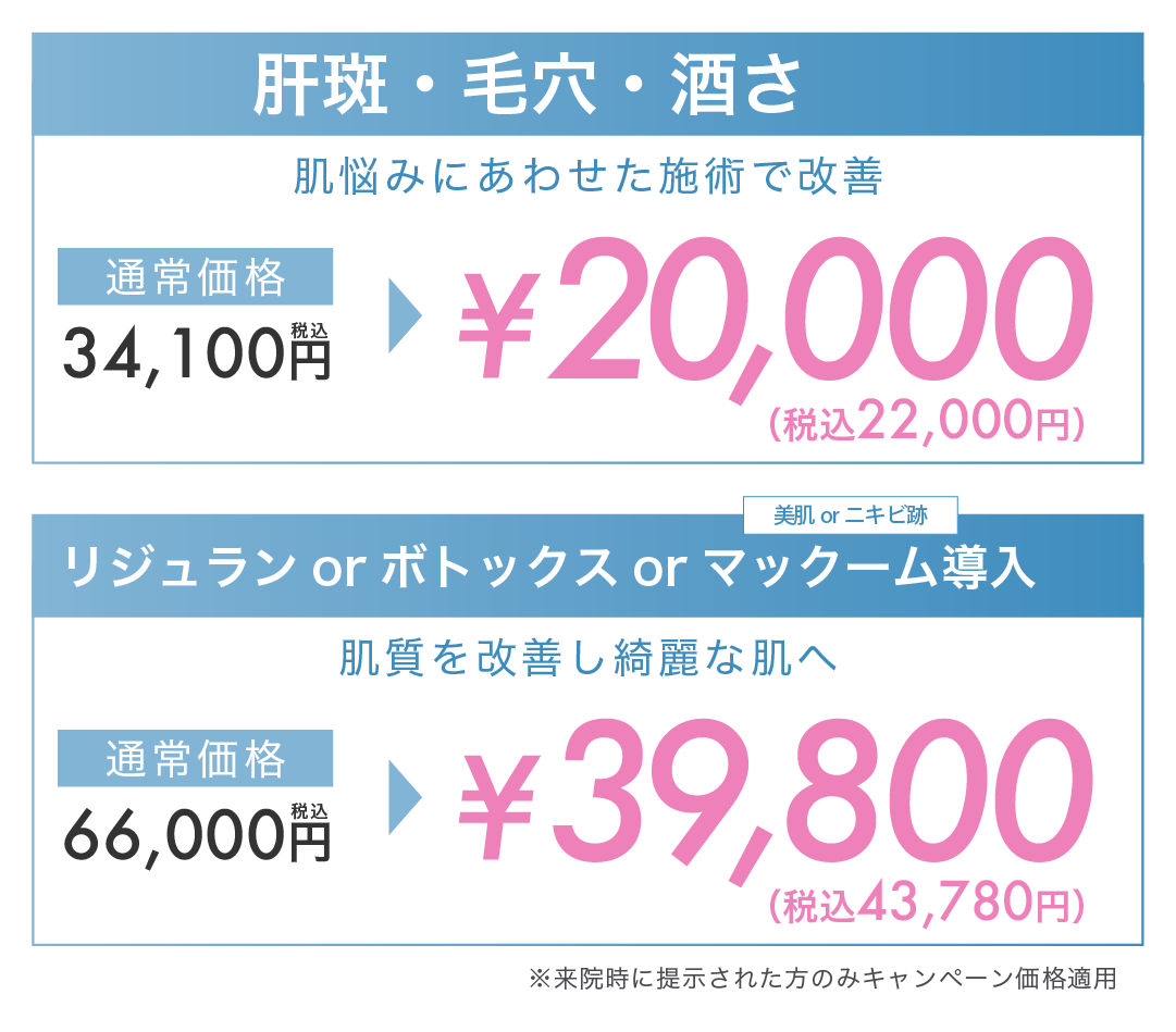 ポテンツァ期間限定キャンペーン