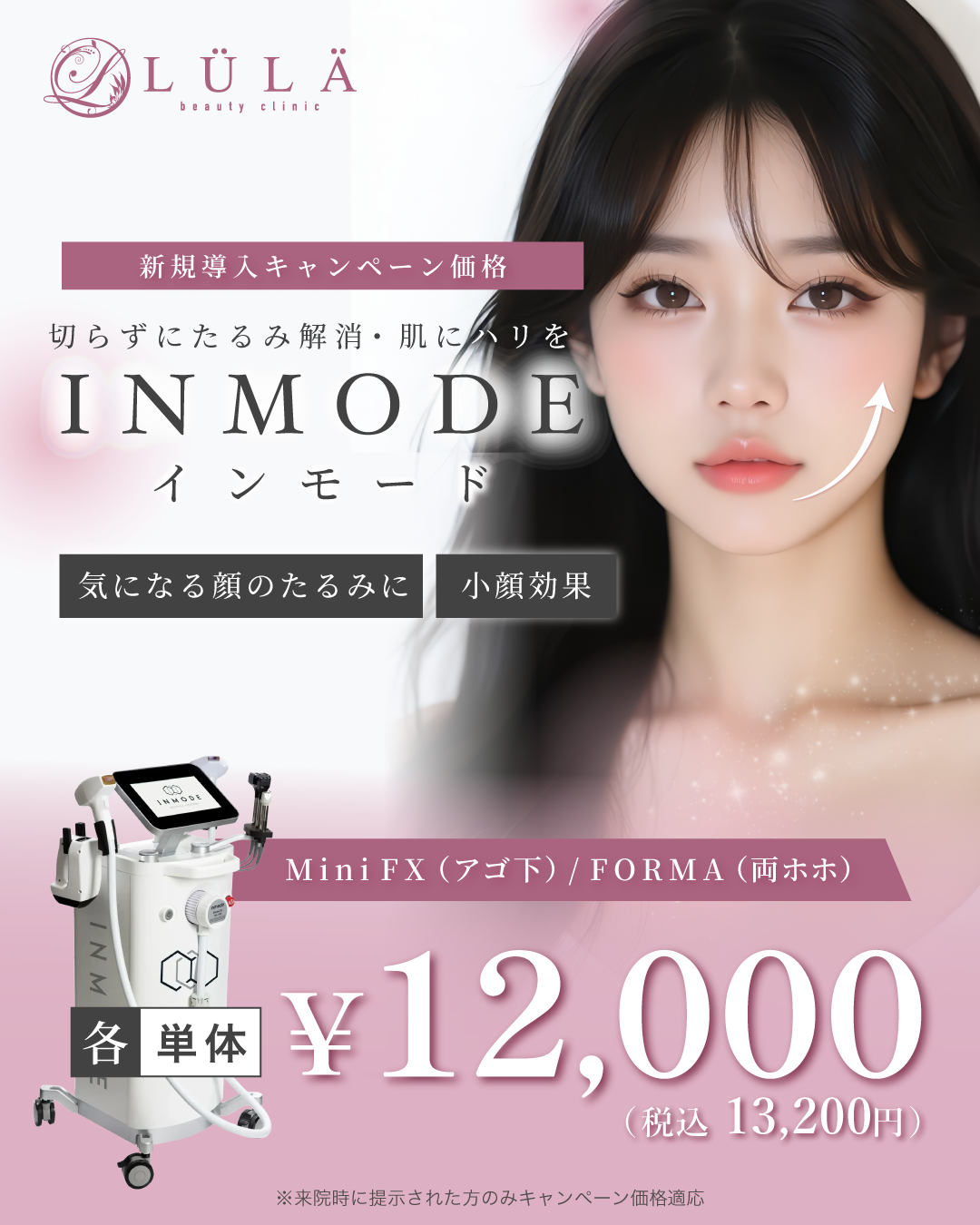 >インモードVリフトとは