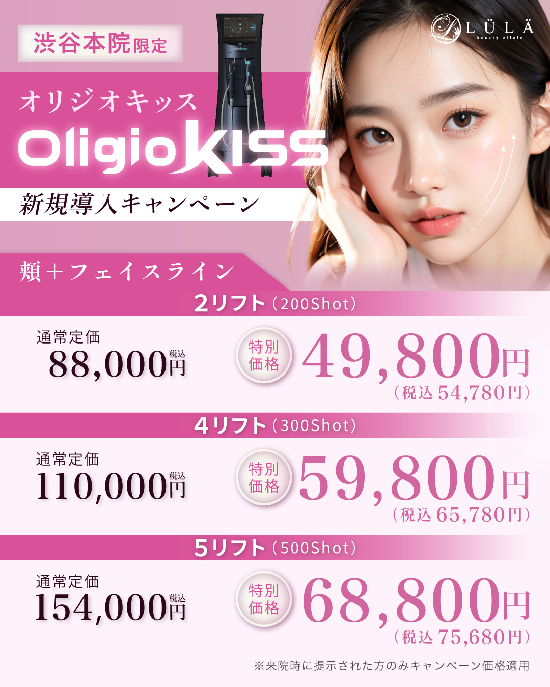 オリジオKissとは