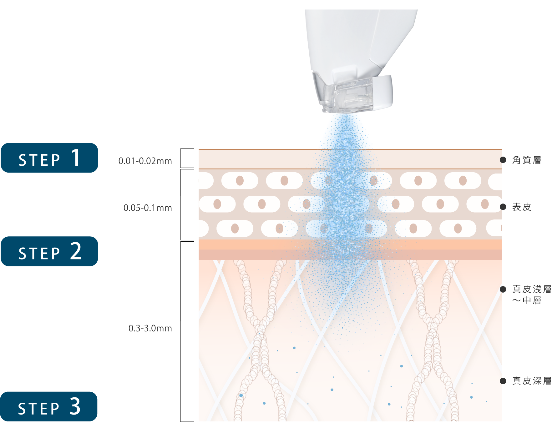 IceNeedling 3ステップ図解